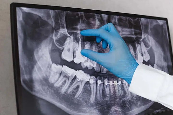 https://m2mdentalclinics.com/wp-content/uploads/2025/05/01-10.jpg