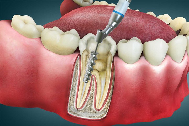 https://m2mdentalclinics.com/wp-content/uploads/2025/05/02-10.jpg