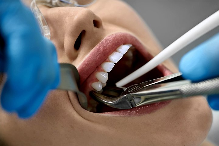 https://m2mdentalclinics.com/wp-content/uploads/2025/05/02-11.jpg