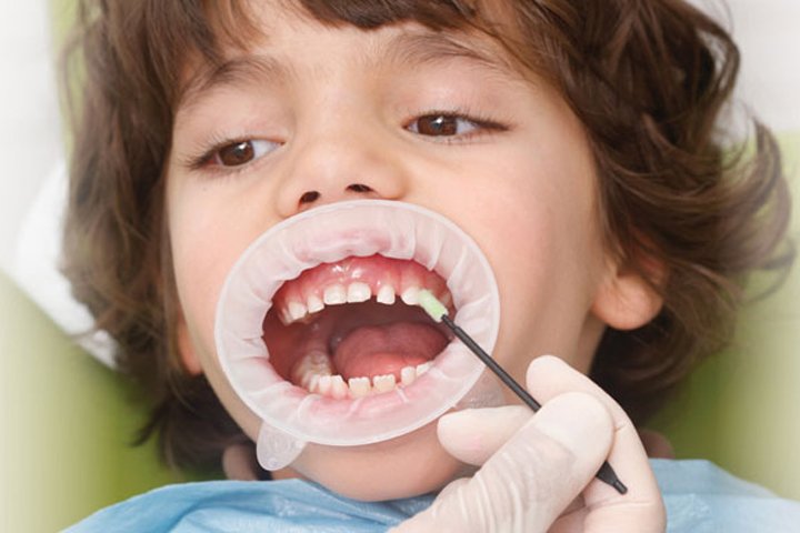 02 https://m2mdentalclinics.com/wp-content/uploads/2025/05/02-3.jpg