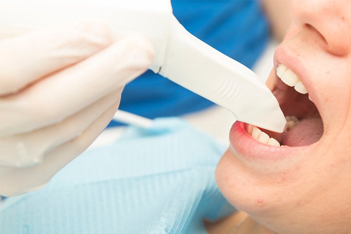 https://m2mdentalclinics.com/wp-content/uploads/2025/05/02-4.jpg