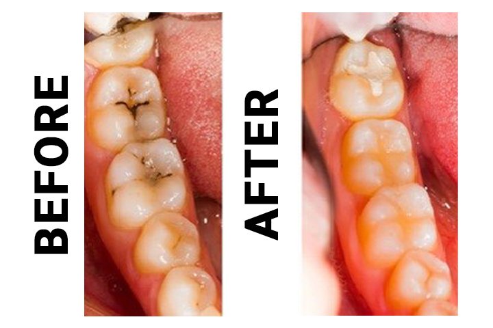 02 https://m2mdentalclinics.com/wp-content/uploads/2025/05/02-6.jpg