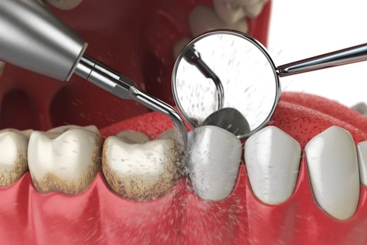02 https://m2mdentalclinics.com/wp-content/uploads/2025/05/02-7.jpg