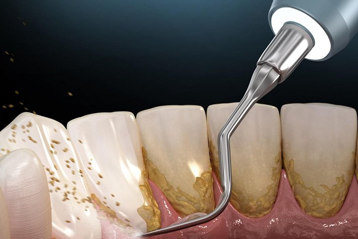 02 https://m2mdentalclinics.com/wp-content/uploads/2025/05/02-9.jpg