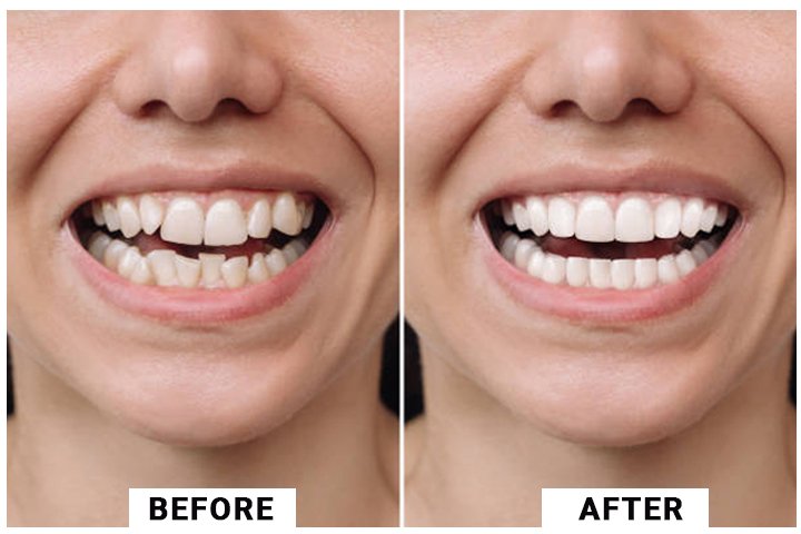 https://m2mdentalclinics.com/wp-content/uploads/2025/05/03-11.jpg
