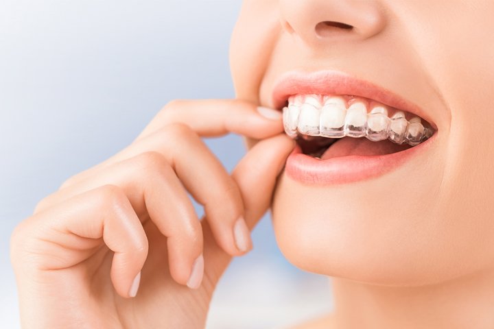 https://m2mdentalclinics.com/wp-content/uploads/2025/05/03-3.jpg