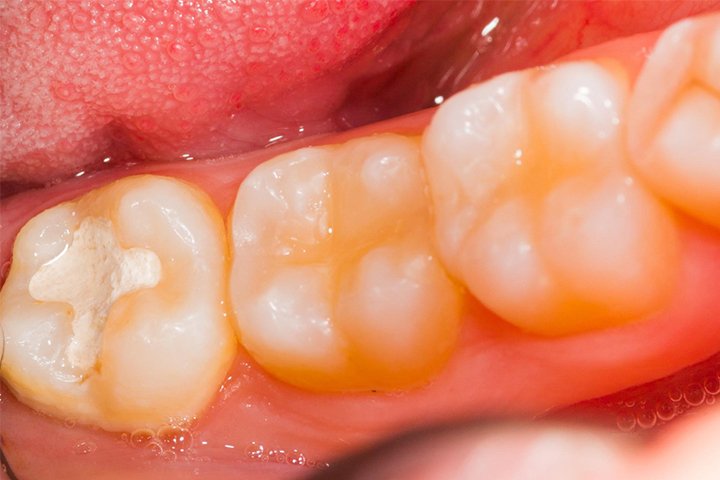 03 https://m2mdentalclinics.com/wp-content/uploads/2025/05/03-6.jpg