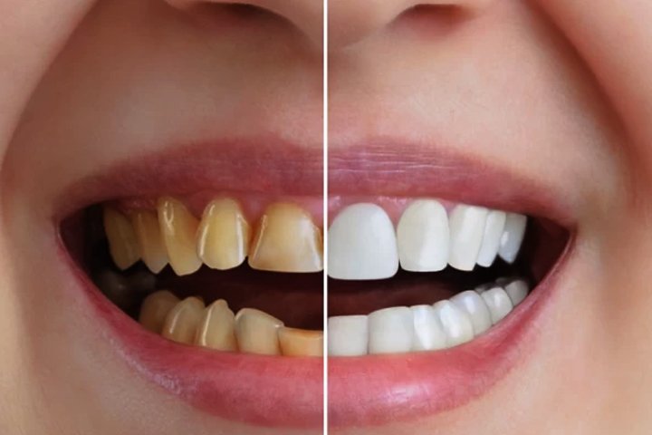 03 https://m2mdentalclinics.com/wp-content/uploads/2025/05/03-9.jpg