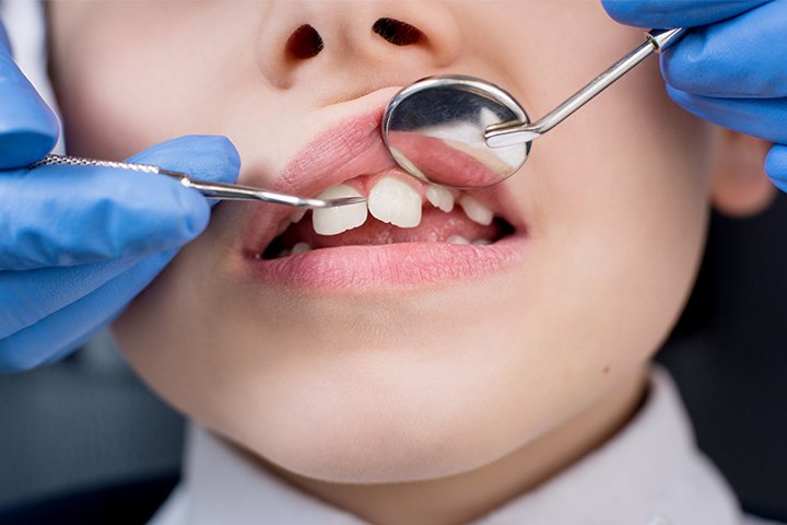 04 https://m2mdentalclinics.com/wp-content/uploads/2025/05/04.jpg