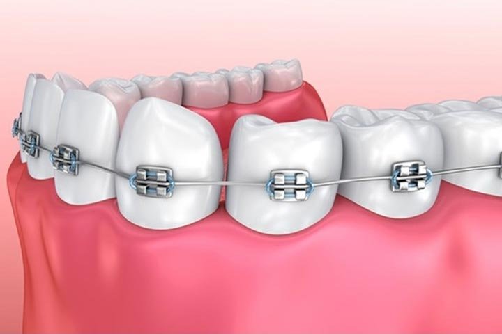 https://m2mdentalclinics.com/wp-content/uploads/2025/07/002.jpg