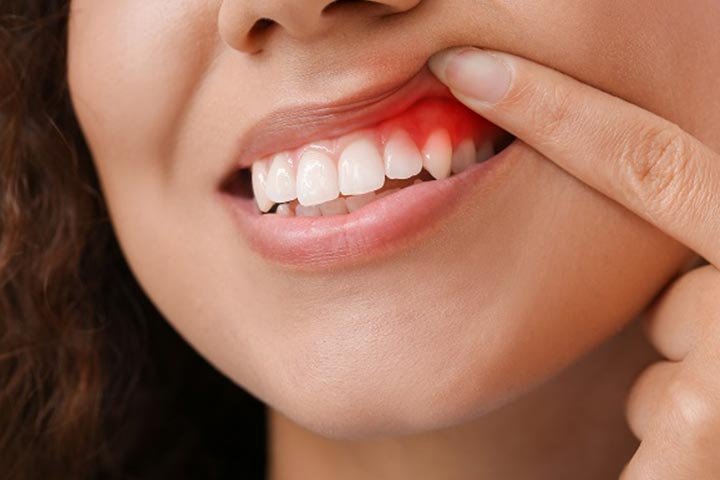 Advanced-Gum-Treatment-002image https://m2mdentalclinics.com/wp-content/uploads/2025/07/Advanced-Gum-Treatment-002image.jpg